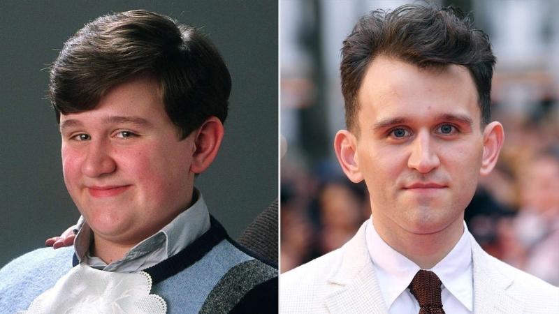 Harry Melling